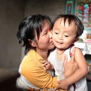 Dang Hong Dan is four years old but he bears the scars of the Vietnam war that came to an end 40 years ago (Unicef/PA)