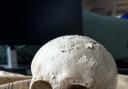 Police find 'skull' in Pickering beck