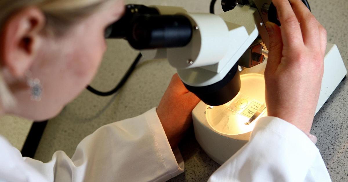Researchers identify cases of Alzheimer's believed to be transmitted from donors - Vimarsana News