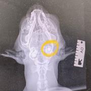The x-ray shows the pellet within Jack's face